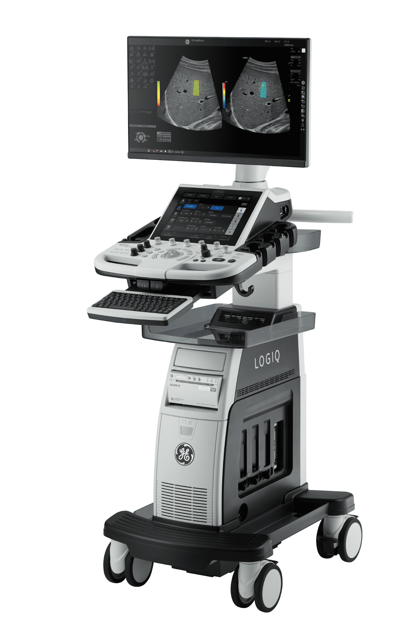 Ultrasound