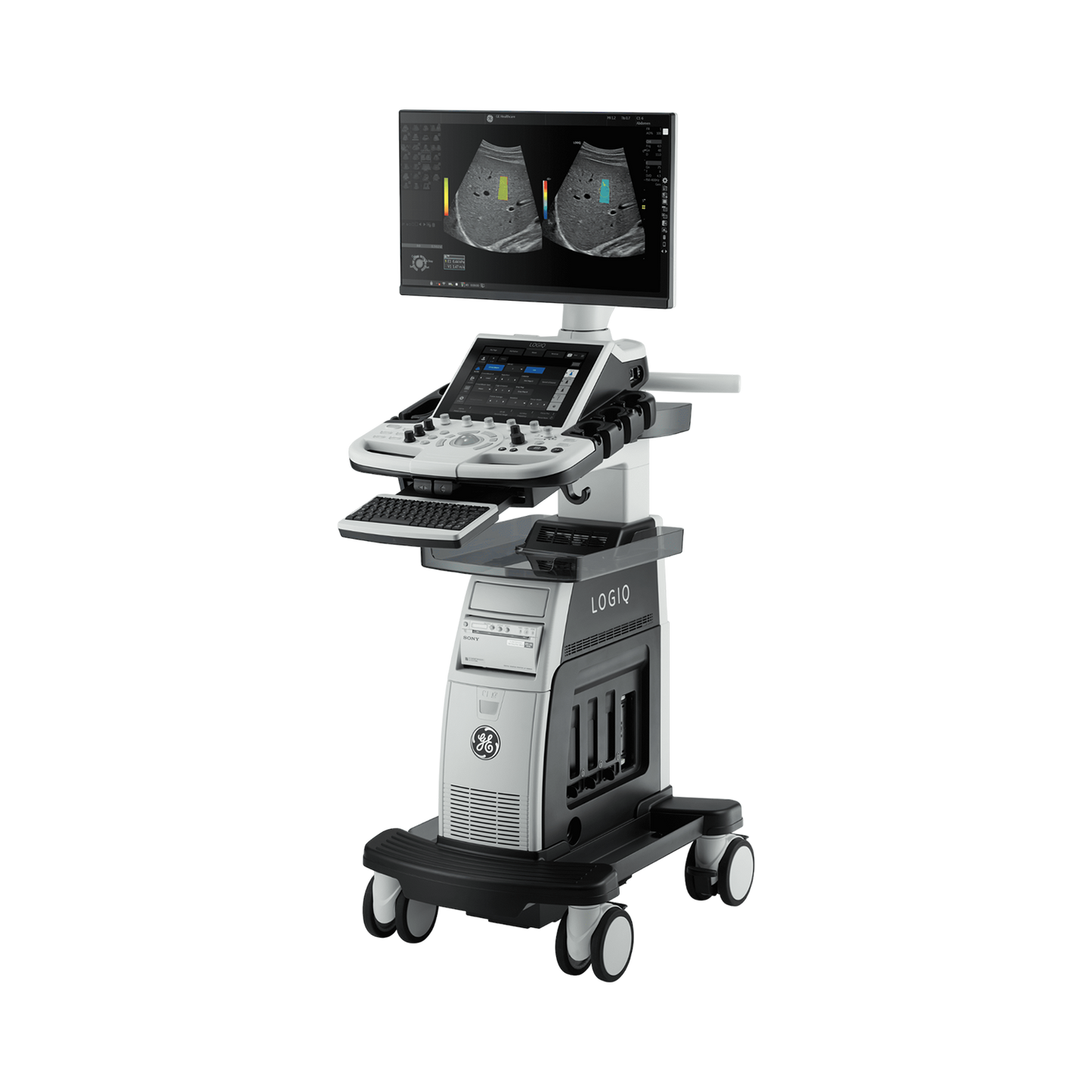 GE LOGIQ P10 XDclear Ultrasound Machine/System