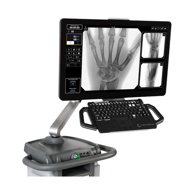 Ziehm Orthoscan TAU 1515 Mini C-Arm System